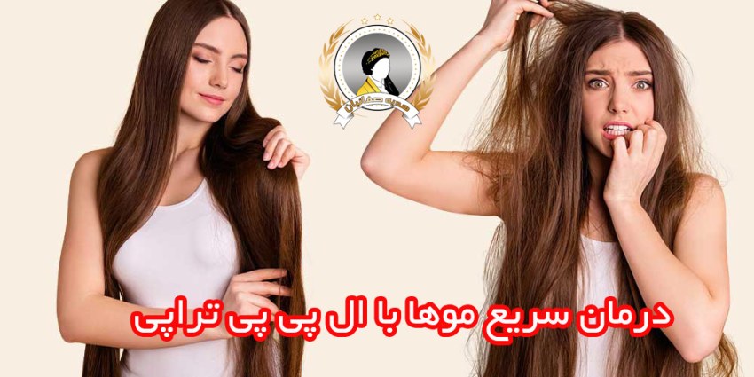 دختری با موهای بلند قهوه ای که آسیب دیده و با ال پی پی تراپی احیا شده موهاش
