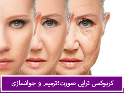 کربوکسی تراپی صورت | مزایا و کاربرد کربوکسی تراپی در زیبایی